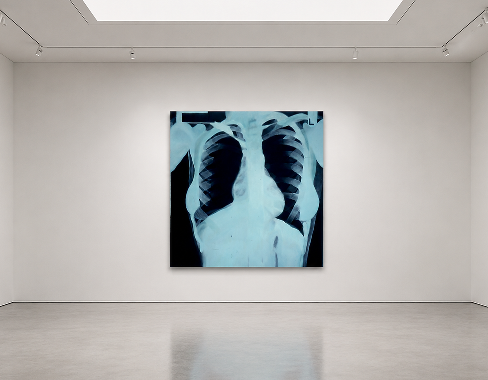 Chest X-Ray
