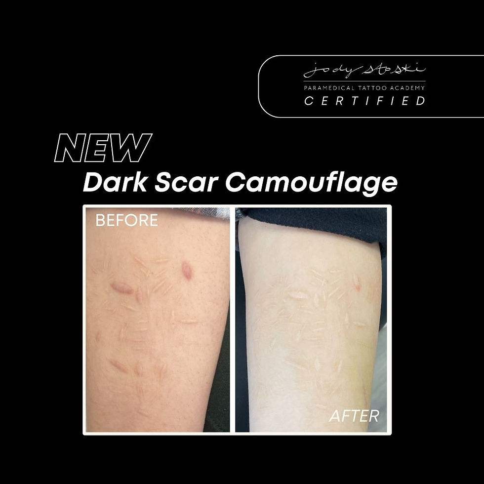 Self Harm Scar Camouflage