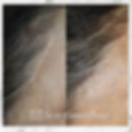 Scar Camouflage Maynard MA
