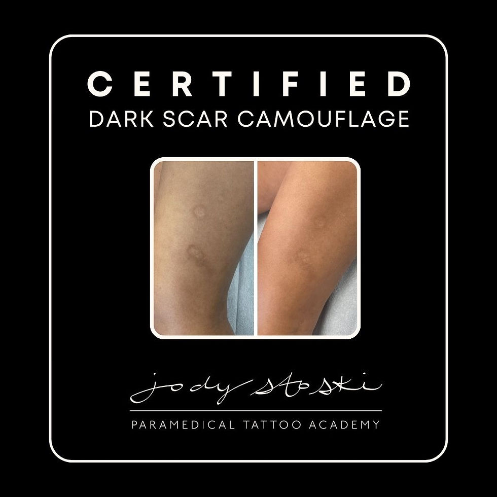 Self Harm Scar Camouflage