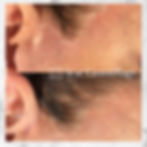 Scar Camouflage Maynard MA