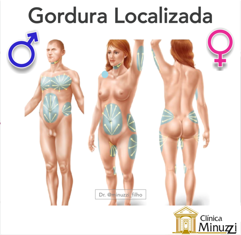 gordura-localizada