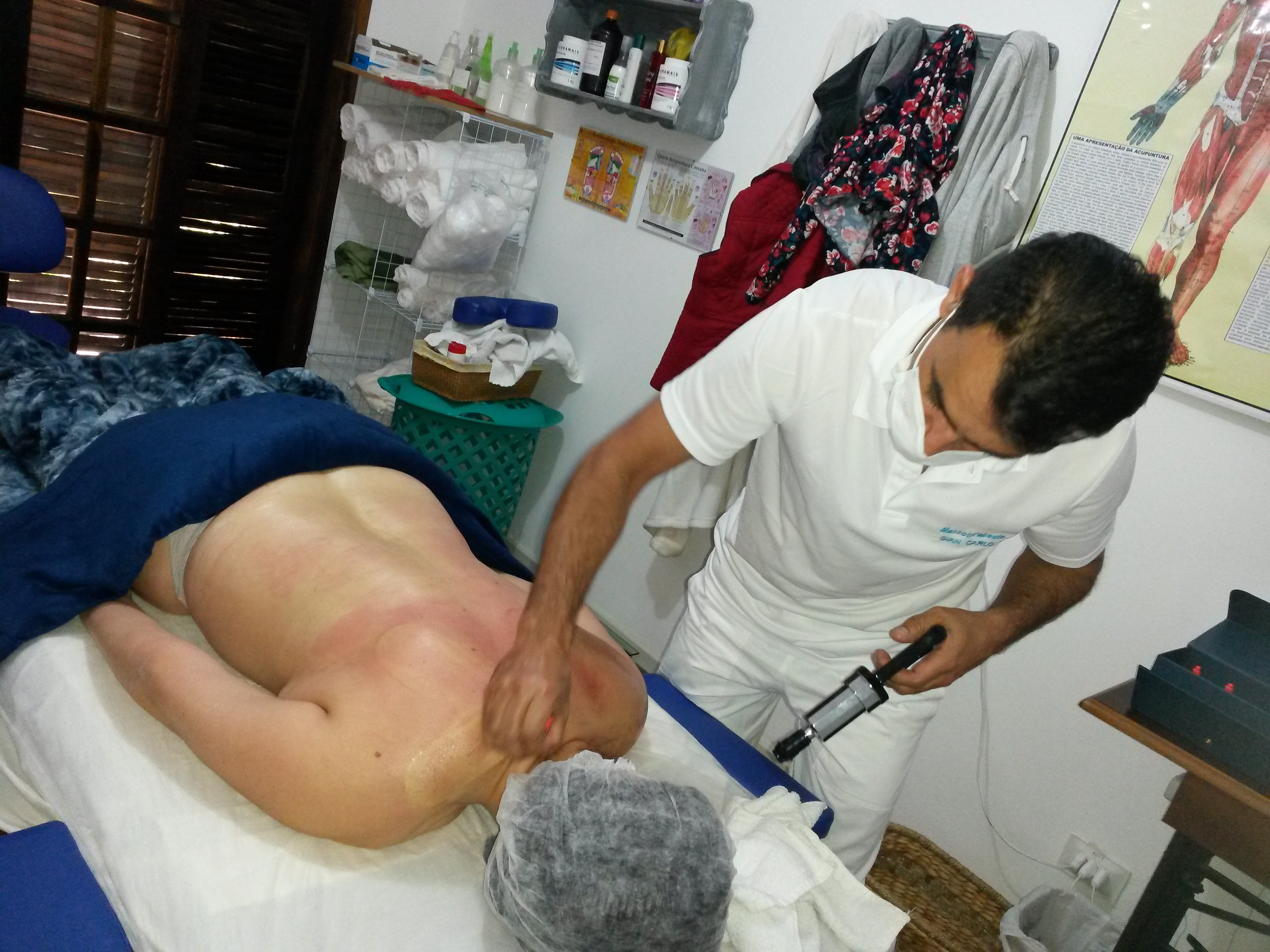 Ventosas no relaxamento