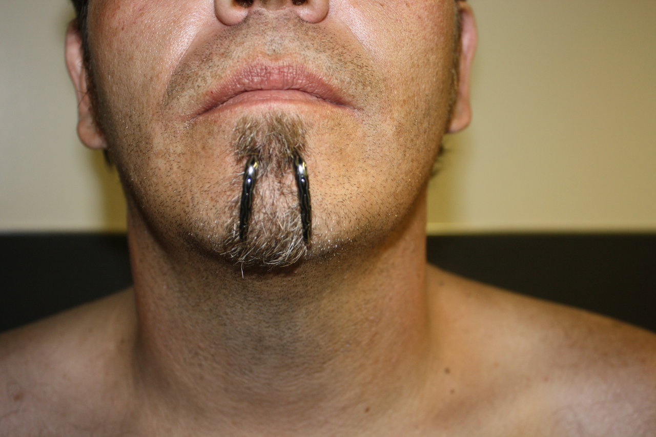 Double labret