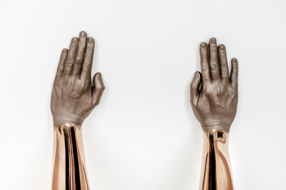 Thumbnail: Golden Hands | iPhone Case