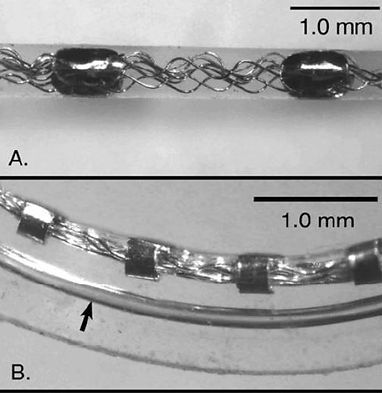 Website Cochlear 4.JPG