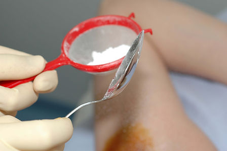 tratamiento botox hiperhidrosis.Consultori Azon-Torres