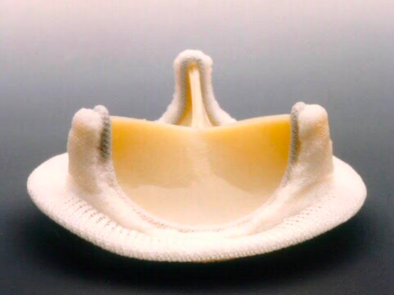 Aortic Valve Replacement