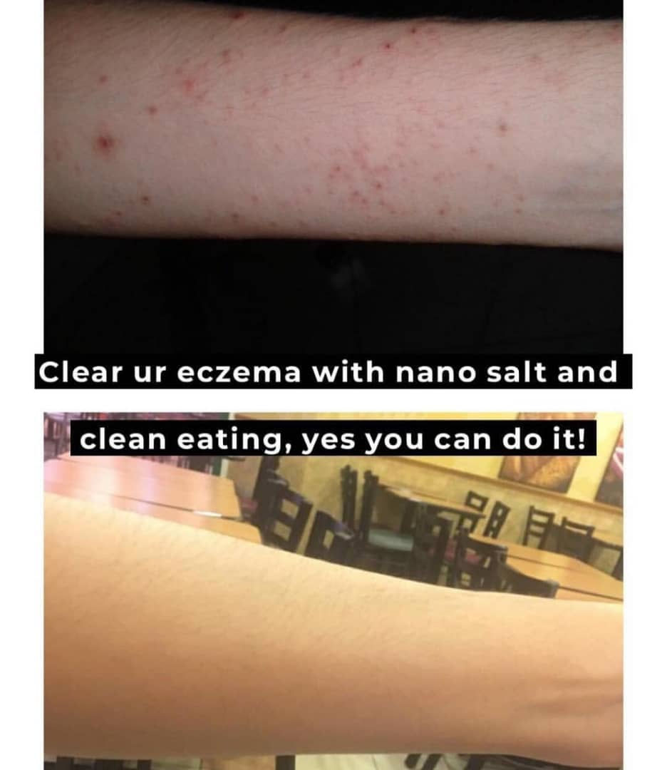 ree