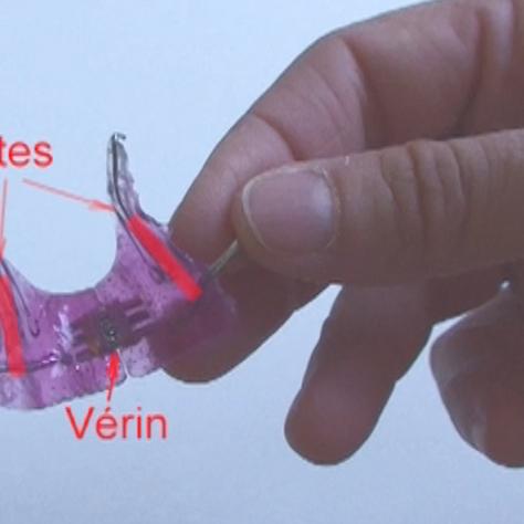 Images de plaque à pistes - Orthodontie