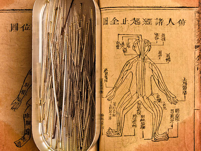 La médecine traditionnelle chinoise (MTC)