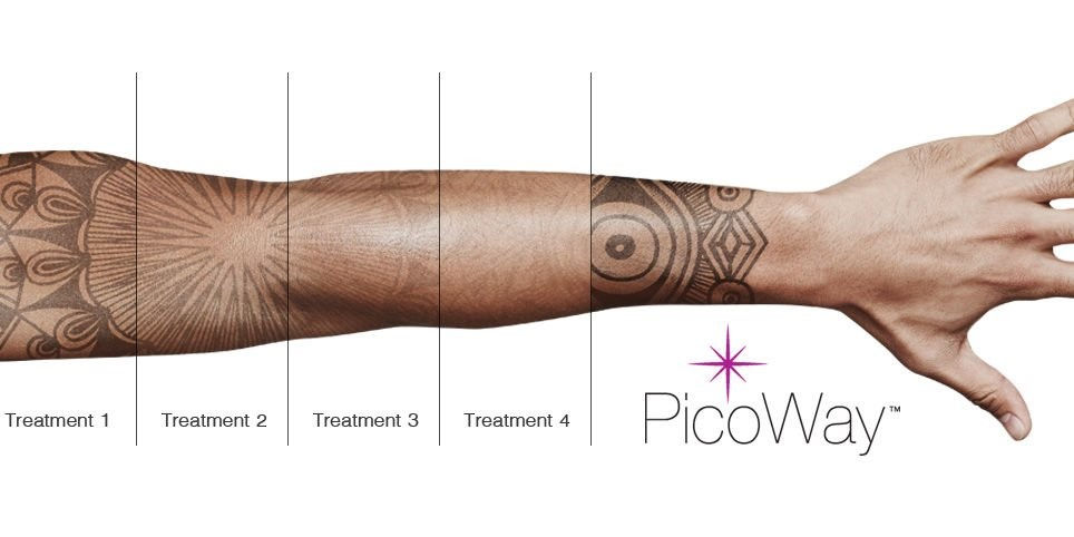 picoway-img.jpg