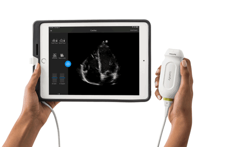 Ultrasound