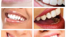 Cirurgia do sorriso