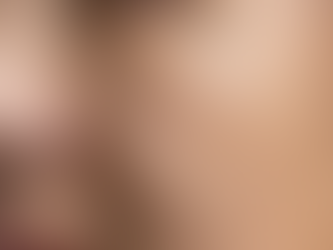 Pigmentation vs Melasma: What's the Difference?