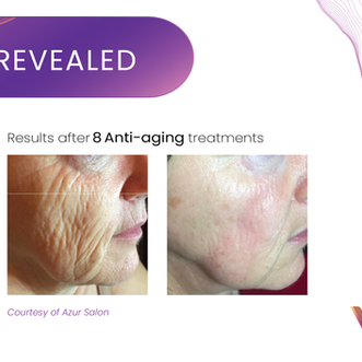 Anti-Aging Treatments
in Missouri City, Sugar Land & Houston, TX