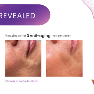 Anti-Aging Treatments
in Missouri City, Sugar Land & Houston, TX
