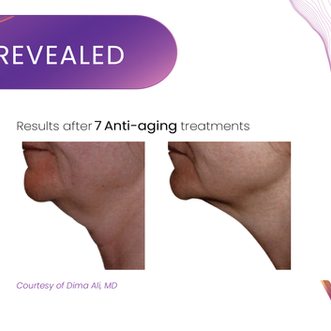 Anti-Aging Treatments
in Missouri City, Sugar Land & Houston, TX