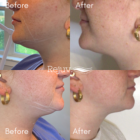 Copy of Copy of Copy of Before and After Instagram Post.png