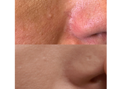 Copy of Copy of Copy of Before and After Instagram Post (1).png