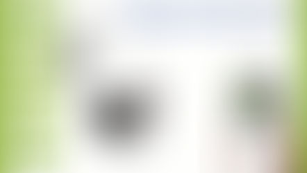 كاميرا واي فاي عالية الدقه ٥ ميجا  متحركه 360 درجة صوت وصوره