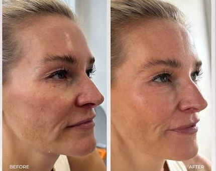 The DNA of Great Skin: Everything You Need to Know About Polynucleotides