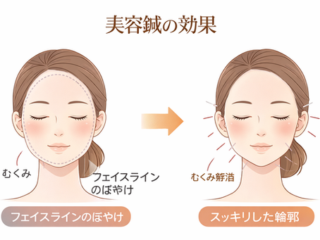 美容鍼で輪郭の左右差を整える理由