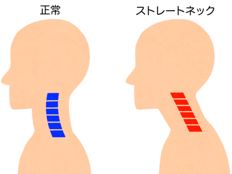スマホ首をリセット！壁一枚でできる30秒の姿勢矯正術