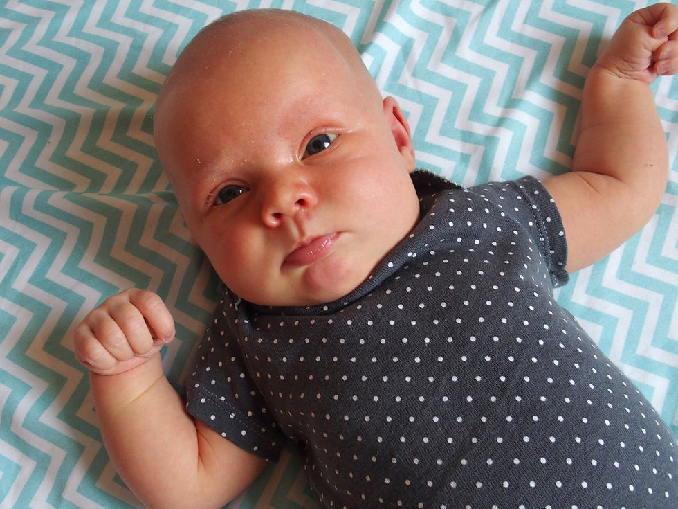 Infant with a preference of looking to the right, with a slight left side neck tilt