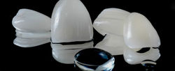 Faceta-dental-estética-610x250