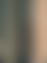 Fluoretação das águas cariocas: equilÃbrio, risco e vigilância sanitária