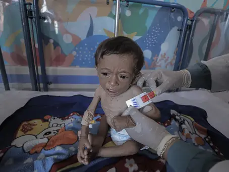 Engineered Hunger: Israel’s Man-Made Famine in Gaza