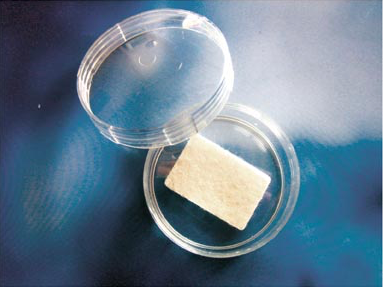 chondrotissue, Knorpelimplantat, Kollagen
