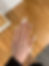 Nail repair (per finger)