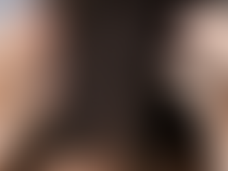 Did You Know That Dandruff is Related to Your Gut Health?