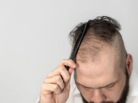 Finasteride 1mg Prices for Long-Term Hair Loss Management