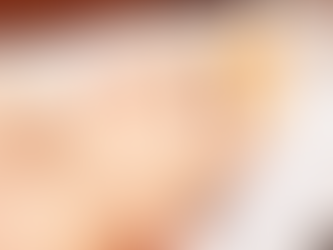 Superficial Chemical Peels for Reducing Mild Skin Congestion