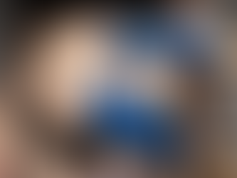 Liposuction Benefits for Men and Women