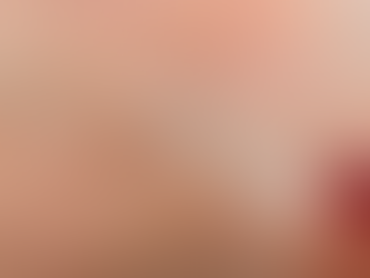 Skin Wart Removal Cost for Simple Wart Types