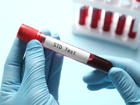 STD Test for Sexual Health Awareness