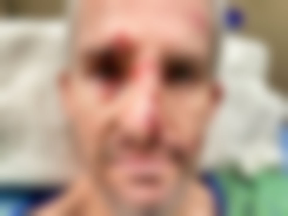Photos of Marius After the Attack
