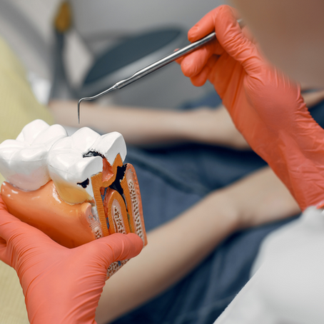 Endodoncia: ¿Cuándo es necesaria, y qué esperar?