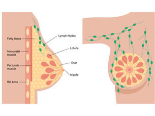 How to Improve Breast Health Naturally: Easy Tips for Lymphatic Support