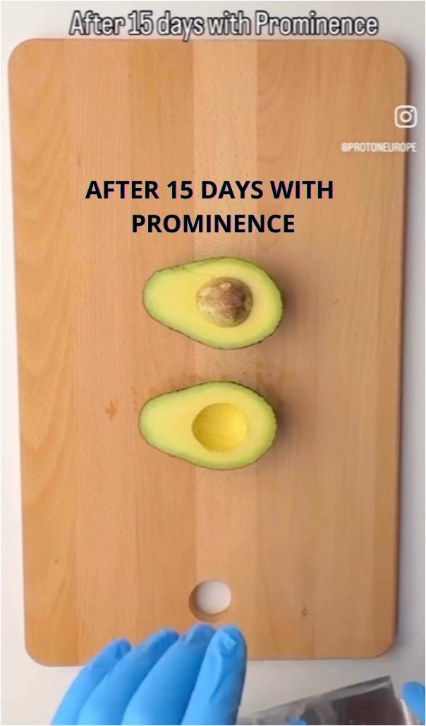 AFTER 15 DAYS WITH PROMINENCE.png