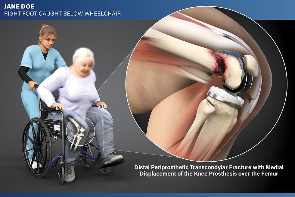 The Biggest Misconception Attorneys Have About Visuals