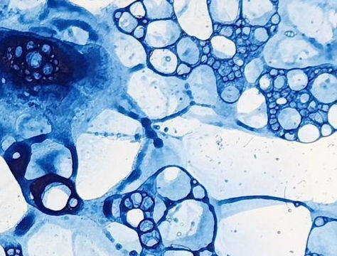 Lactobacilos: a flora que protege fertilidade e gestação