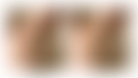 Depilacja laserowa – efekty krok po kroku. Czego możesz się spodziewać?