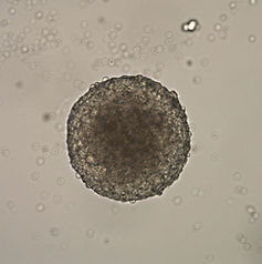 Embryoid body compressed (1).jpg