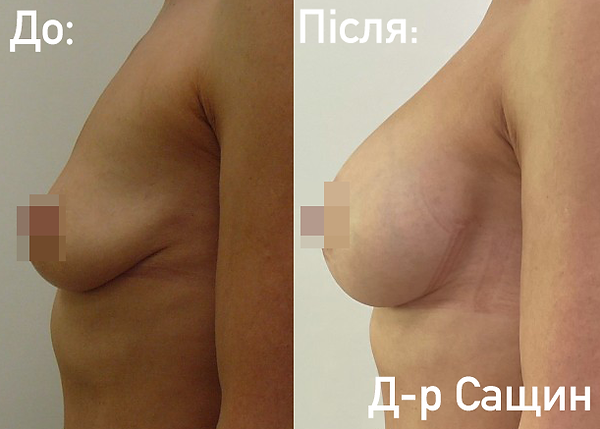 Естетичний хірург Віктор Сащин.png