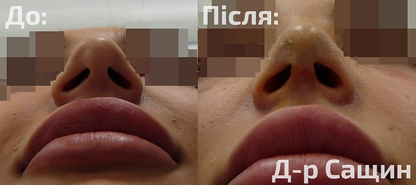 Доктор хірург пластичний Віктор Володими